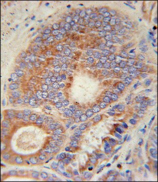 ANTI-HHAT (N-TERM) antibody produced in rabbit IgG fraction of antiserum, buffered aqueous solution