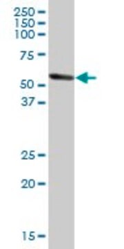 Anti-ALDH1A1 antibody produced in mouse purified immunoglobulin, buffered aqueous solution