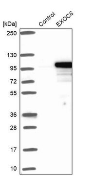 Anti-EXOC6 antibody produced in rabbit Prestige Antibodies&#174; Powered by Atlas Antibodies, affinity isolated antibody, buffered aqueous glycerol solution