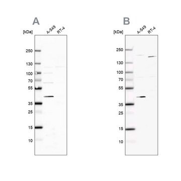 Anti-GALK1 antibody produced in rabbit Prestige Antibodies&#174; Powered by Atlas Antibodies, affinity isolated antibody, buffered aqueous glycerol solution