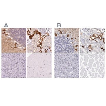 Anti-CALB1 antibody produced in rabbit Prestige Antibodies&#174; Powered by Atlas Antibodies, affinity isolated antibody, buffered aqueous glycerol solution