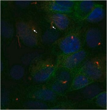 Anti-Fibrocystin Antibody, clone 18 clone 18, from mouse