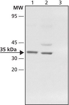 Anti-CHIP (N-terminal) antibody produced in rabbit ~1&#160;mg/mL, affinity isolated antibody, buffered aqueous solution