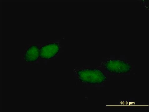 Anti-TBL1X antibody produced in mouse purified immunoglobulin, buffered aqueous solution