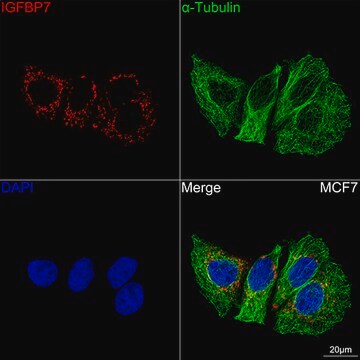 Anti-IGFBP7 Antibody, clone 8M10Q9, Rabbit Monoclonal