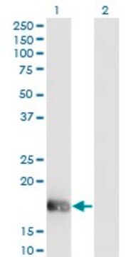 Monoclonal Anti-OMP antibody produced in mouse clone 2B7, purified immunoglobulin, buffered aqueous solution