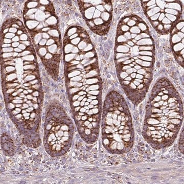 Anti-SQRDL antibody produced in rabbit Prestige Antibodies&#174; Powered by Atlas Antibodies, affinity isolated antibody, buffered aqueous glycerol solution