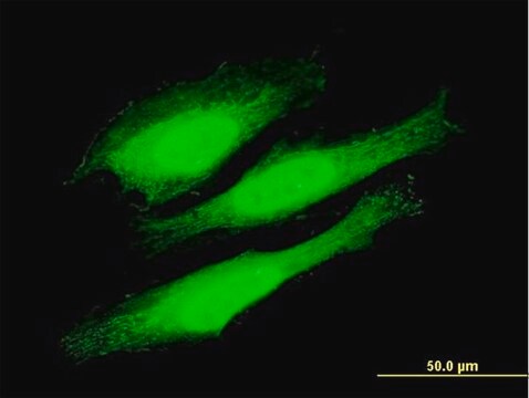 Anti-KIAA1967 antibody produced in mouse purified immunoglobulin, buffered aqueous solution