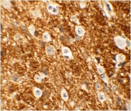 Anti-ROCK2 Antibody from rabbit, purified by affinity chromatography