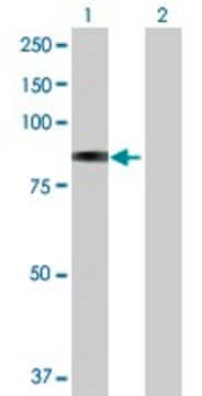 Anti-GLB1 antibody produced in rabbit purified immunoglobulin, buffered aqueous solution