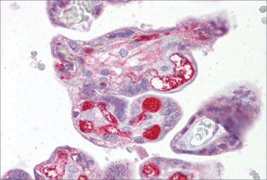 Anti-SLC26A4 antibody produced in rabbit affinity isolated antibody