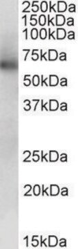 Anti-ALDH1B1 antibody produced in goat affinity isolated antibody, buffered aqueous solution