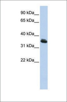 Anti-LHX3 antibody produced in rabbit affinity isolated antibody