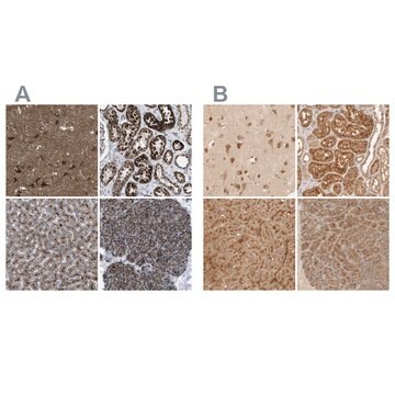 Anti-TMEM192 antibody produced in rabbit Prestige Antibodies&#174; Powered by Atlas Antibodies, affinity isolated antibody, buffered aqueous glycerol solution