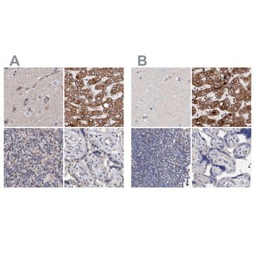 Anti-DECR1 antibody produced in rabbit Prestige Antibodies&#174; Powered by Atlas Antibodies, affinity isolated antibody, buffered aqueous glycerol solution, Ab2