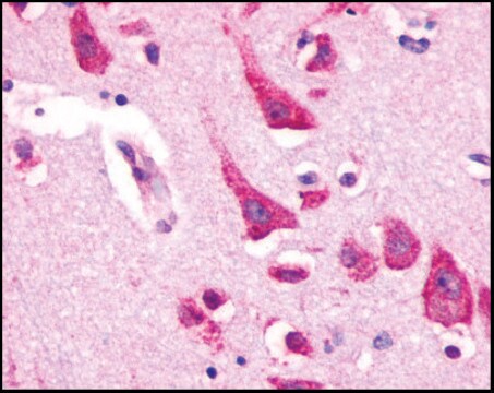 Anti-CXCR4 antibody produced in rabbit affinity isolated antibody, buffered aqueous solution