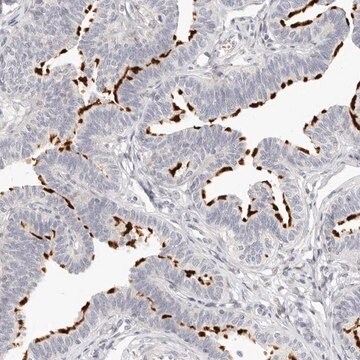 Anti-LTB4R2 antibody produced in rabbit Prestige Antibodies&#174; Powered by Atlas Antibodies, affinity isolated antibody, buffered aqueous glycerol solution