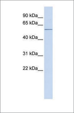 Anti-ACVR1C antibody produced in rabbit affinity isolated antibody