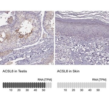 Anti-ACSL6 antibody produced in rabbit affinity isolated antibody, buffered aqueous glycerol solution