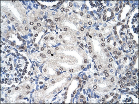 Anti-FOXJ1 antibody produced in rabbit affinity isolated antibody