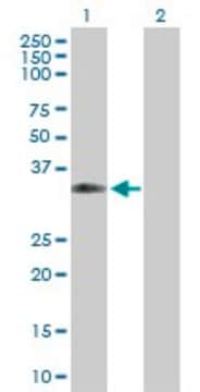 Anti-CPNE5 antibody produced in mouse purified immunoglobulin, buffered aqueous solution