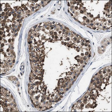 Anti-ABCC9 antibody produced in rabbit Prestige Antibodies&#174; Powered by Atlas Antibodies, affinity isolated antibody, buffered aqueous glycerol solution