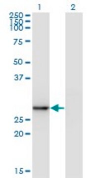 Monoclonal Anti-EXOSC5, (N-terminal) antibody produced in mouse clone 1E11, purified immunoglobulin, buffered aqueous solution