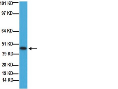 Anti-Growth Associated Protein 43-Antikörper, Klon 9-1E12 clone 9-1E12, Chemicon&#174;, from mouse