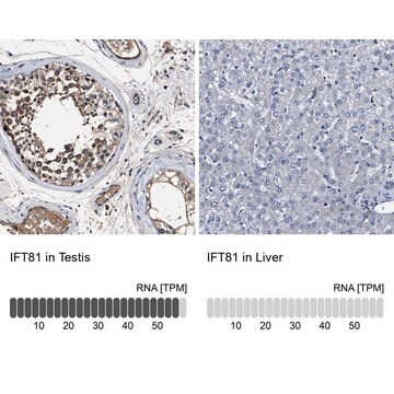 Anti-IFT81 antibody produced in rabbit Prestige Antibodies&#174; Powered by Atlas Antibodies, affinity isolated antibody, buffered aqueous glycerol solution, Ab2