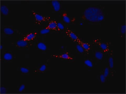 Anti-EDC4 (N-terminal) antibody produced in rabbit ~1.0&#160;mg/mL, affinity isolated antibody