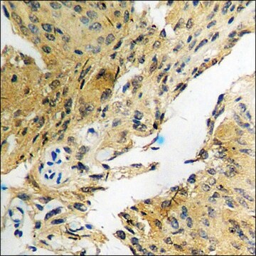 Anti-phospho-FKHR (pSer319) antibody produced in rabbit affinity isolated antibody