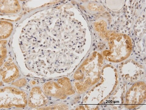 Anti-SUOX, (N-terminal) antibody produced in mouse purified immunoglobulin, buffered aqueous solution