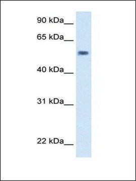 Anti-EXD antibody produced in rabbit IgG fraction of antiserum