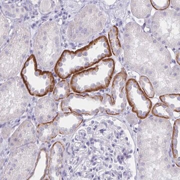 Anti-SAP25 antibody produced in rabbit Prestige Antibodies&#174; Powered by Atlas Antibodies, affinity isolated antibody, buffered aqueous glycerol solution