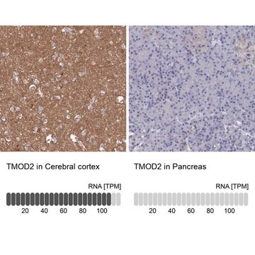 Anti-TMOD2 antibody produced in rabbit Prestige Antibodies&#174; Powered by Atlas Antibodies, affinity isolated antibody, buffered aqueous glycerol solution