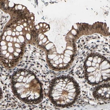 Anti-THAP12 antibody produced in rabbit Prestige Antibodies&#174; Powered by Atlas Antibodies, affinity isolated antibody, buffered aqueous glycerol solution