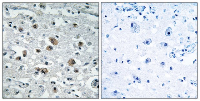 Anti-GASP1 antibody produced in rabbit affinity isolated antibody