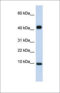 Anti-CCL8 antibody produced in rabbit affinity isolated antibody