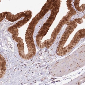 Anti-TRIM32 antibody produced in rabbit Prestige Antibodies&#174; Powered by Atlas Antibodies, affinity isolated antibody, buffered aqueous glycerol solution