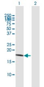 Anti-IL10 antibody produced in mouse purified immunoglobulin, buffered aqueous solution