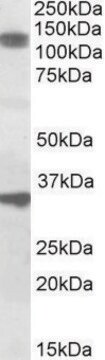 Anti-CCAR1 antibody produced in goat affinity isolated antibody, buffered aqueous solution