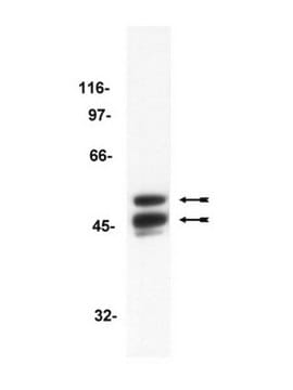 Anti-GSK3-Antikörper, Klon 4G-1E clone 4G-1E, Upstate&#174;, from mouse