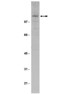 Anti-JAK3 Antibody serum, Upstate&#174;