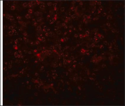 Anti-SLFN14 antibody produced in rabbit affinity isolated antibody, buffered aqueous solution