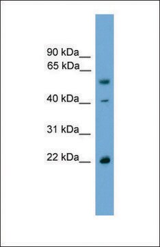 Anti-WBP4, (N-terminal) antibody produced in rabbit affinity isolated antibody