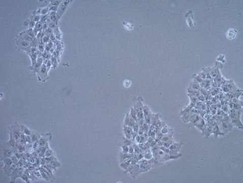 UM-SCC-17A Squamous Carcinoma Cell Line UM-SCC-17A is a unique head and neck squamous carcinoma cell line isolated from the primary laryngeal carcinoma of a 48-year old female patient who failed to respond to radiation therapy and is a suitable in vitro model of H&amp;N carcinoma studies.