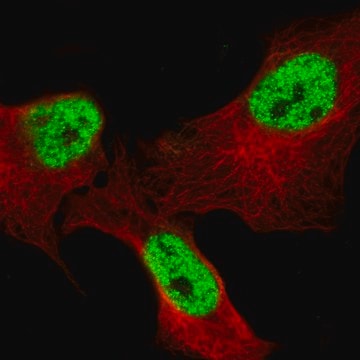 Monoclonal Anti-Bcl6 Antibody Produced In Mouse Prestige Antibodies&#174; Powered by Atlas Antibodies, clone CL14612, affinity isolated antibody, buffered aqueous glycerol solution