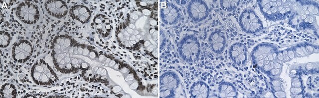 Anti-TRIM28/KAP-1 Antibody, clone 1G5 ZooMAb&#174; Rabbit Monoclonal recombinant, expressed in HEK 293 cells