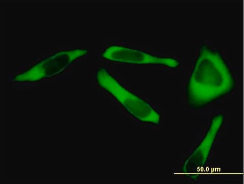 Anti-RARS antibody produced in mouse purified immunoglobulin, buffered aqueous solution