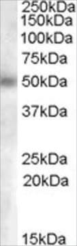 Anti-GCNT3 (AA 273-284) antibody produced in goat affinity isolated antibody, buffered aqueous solution